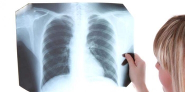 Çocuklarda tüberküloz nedenleri