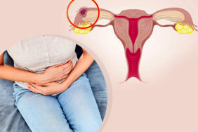 Dış Gebelik Nedenleri