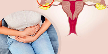 Dış Gebelik Nedenleri